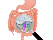 结肠镜检查的意义是什么?