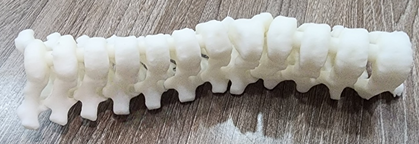 胸椎骨3D打印模型
